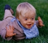 Child with Downs Syndrome