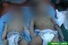 Babies in Tripoli, one shown alive (left) killed by NATO bombs