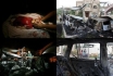 Casualties of Israeli attacks in Gaza