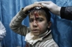 Injured child in Gaza after Israeli attack