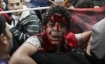 Wounded protester carried to Tahrir square makeshift hospital on Monday 21 November