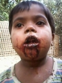 4-Year-Old Rohingya Girl Mercilessly Beaten By Military Men