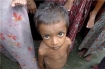 Rohingya child