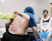 Abuse and violence against Indonesian migrant workers in Saudi Arabia.