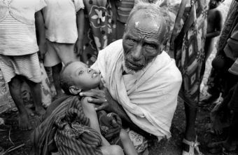 Child starving in Ethiopia