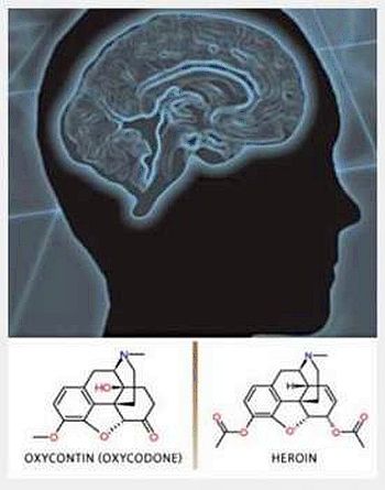 opioid brain